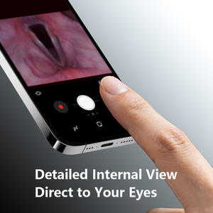 Otoscopio WiFi HD 1080P con 6 Luces LED, Cámara Eléctrica de Plástico para Oído y Nariz para Niños y Adultos - Dispositivo Médico Doméstico - Product Image 3