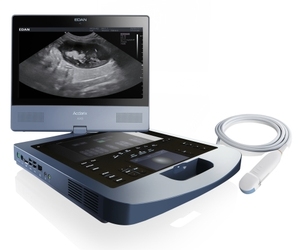 Échographe Doppler Couleur Portable Haute Performance Edan AX8 pour Usage Humain - Product Image 1