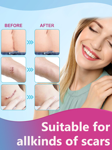 Toppa cicatrice in Silicone personalizzabile clinicamente provata guarigione con confezione elegante-perfetta per regali e uso personale - Product Image 4
