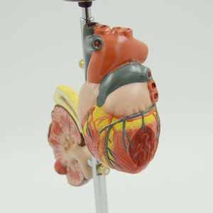 Model Patologi Komplikasi <span class=keywords><strong>Diabetes</strong></span> Bersertifikat CE Mata/Jantung/Ginjal/Selang Pendarahan/Kaki untuk Demonstrasi Pendidikan Medis - Product Image 3