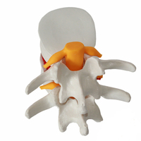 Modelo de demostración de enseñanza asistida, modelo de hernia de disco lumbar, modelo de disco intervertebral