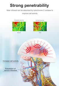 Helm Terapi Neuro Suyzeko 1070nm, Mesin Terapi Cahaya LED Neurotherapy, Helm Fotobiomodulasi Otak untuk Terapi Otak Neuro - Product Image 2