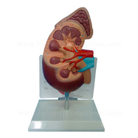 De anatomía riñón humano modelo