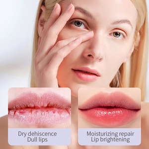 Private Label Custom OEM 6 frutta burro di karitè naturale organico idratante balsamo per le labbra Stick Set Chapstick con miele mela cocco - Product Image 2