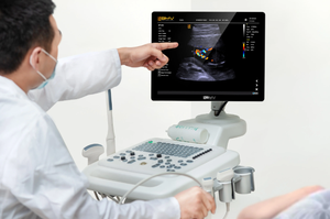 Mesin <span class=keywords><strong>Ultrasound</strong></span> Doppler warna berbasis troli baru 2024 untuk rumah sakit pemindai gema 15 inci - Product Image 4