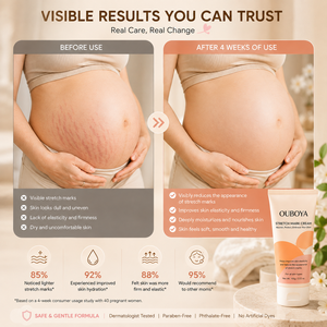 Crème <span class=keywords><strong>anti</strong></span>-vergetures tendance : soutient la résilience cutanée <span class=keywords><strong>avant</strong></span> et après la grossesse - Product Image 6