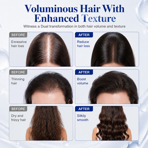 Champú OEM ODM con Biotina para el Crecimiento del Cabello y Revitalización del Cuero Cabelludo, Limpieza Profunda con Péptidos de Cobre GHK-Cu para Cabello Fino - Product Image 5