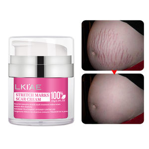 Crème Réparatrice Éclaircissante 100% Naturelle OEM pour Vergetures Quotidiennes Post-Partum et Cicatrices de <span class=keywords><strong>Grossesse</strong></span> <span class=keywords><strong>Anti</strong></span>-Vitamine E 65g - Product Image 2