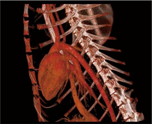 เครื่องสแกนคอมพิวเตอร์断层摄影 (CT) สำหรับสัตวแพทย์ ราคาตัวแทนจำหน่ายยุโรป อุปกรณ์สัตวแพทย์ เครื่อง CT อเนกประสงค์สำหรับโรงพยาบาล - Product Image 6