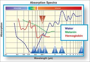 ADSS taşınabilir vasküler kaldırma 980nm tıbbi diyot lazer/980 nm makinesi/örümcek damar kaldırma - Product Image 5