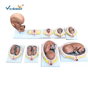 ชุดแบบจำลองการตั้งครรภ์ 9 แบบ สำหรับการศึกษาทางวิทยาศาสตร์การแพทย์  โครงสร้างพัฒนาการของทารกในครรภ์ในช่วงต่างๆ - Product Image 1