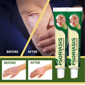 Pommade à base de plantes chinoises naturelles Bangfuke, anti-démangeaisons, eczéma, dermatite, inflammations, éruptions cutanées, traitements du psoriasis, peau, 20g - Product Image 5