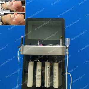 2025 dernière conception Hydra multifonction soins de la peau Machine faciale Vortex bonne aspiration serrage Hydra poignée ampoules - Product Image 5