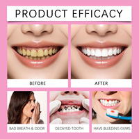 Sérum blanchissant pour les dents Upyour Dally, dentifrice avec soins bucco-dentaires expertes, blanchiment, protection contre les caries, armure dentaire liquide
