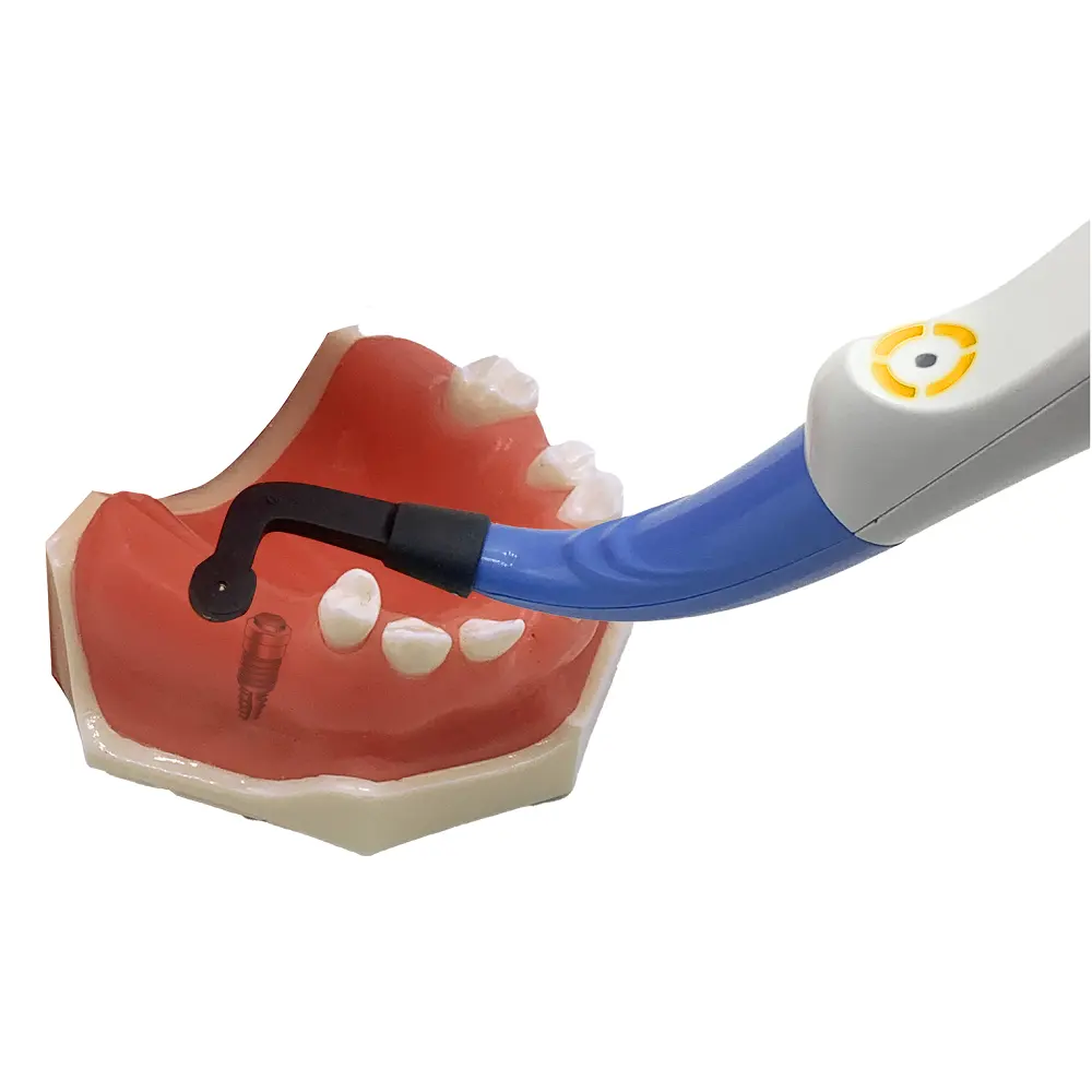 איתור שתלים גלאי שתלים שיניים עבור שתלים שיניים ורפואת שיניים משקמת