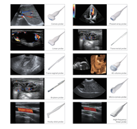 Appareil de Diagnostic de Type chariot à ultrasons de couleur Scanner à ultrasons exclusif Équipement médical portable à ultrasons 3D/4D/5D