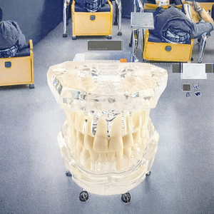Hotseller NieuwBeijing TIANLIAN Transparant Anatomisch Tandmodel Prothese Implantaat Pathologisch Displaymodel - Product Image 4