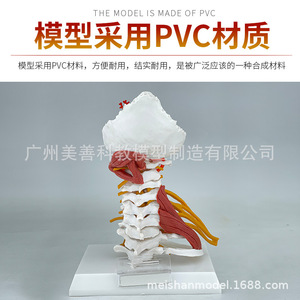 Modèle avancé des muscles de la colonne cervicale, de l'artère carotide, de l'os occipital, du disque intervertébral et des nerfs ; colonne cervicale humaine - Product Image 5