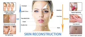 CO2 fraksional peralatan Laser perbaikan bekas luka vagina, tongkat terapi pengencang vagina peremajaan - Product Image 5