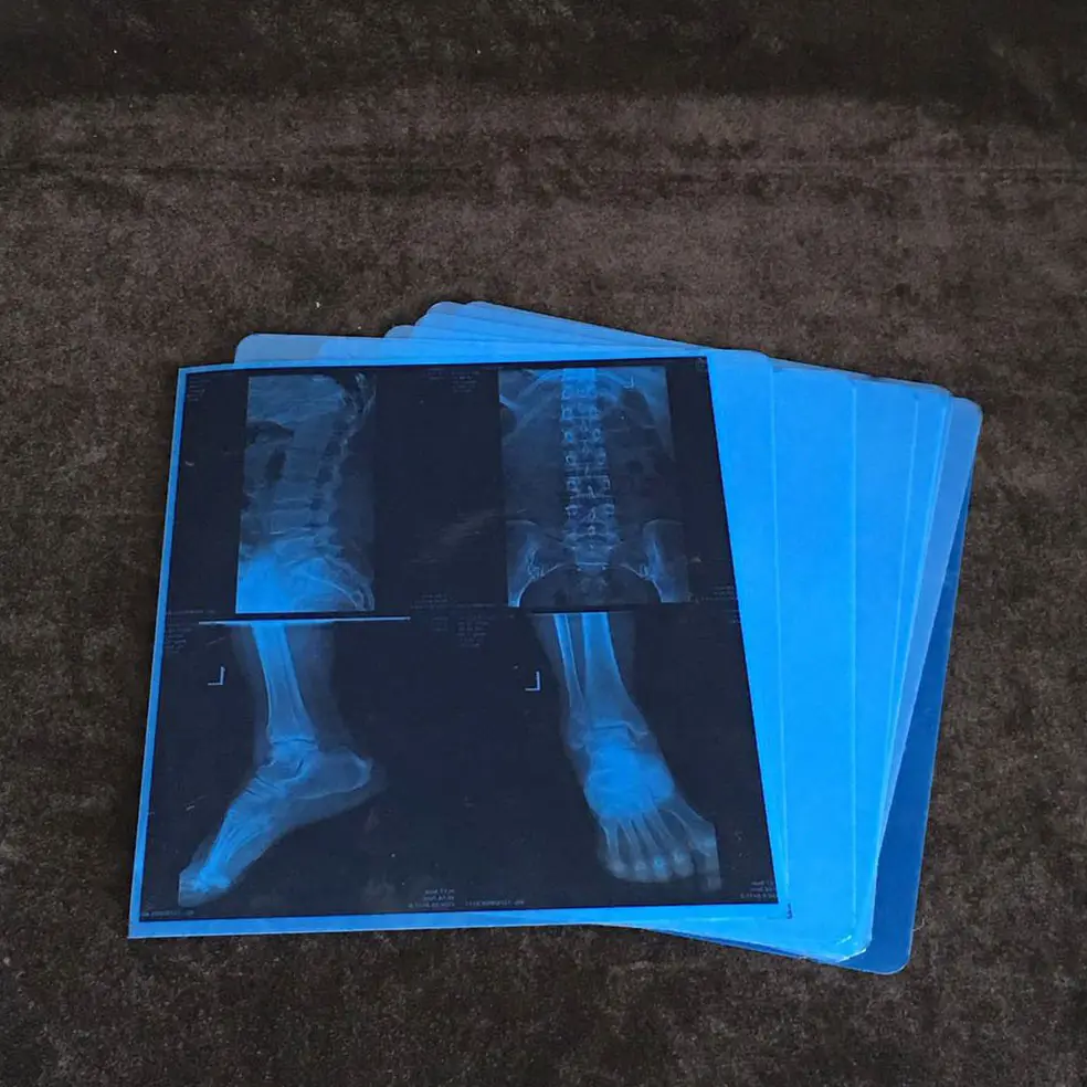Impresión de inyección de tinta X Ray Medical Dry inkjet X-ray Imaging Film para dispositivos Medial Venta directa de fábrica