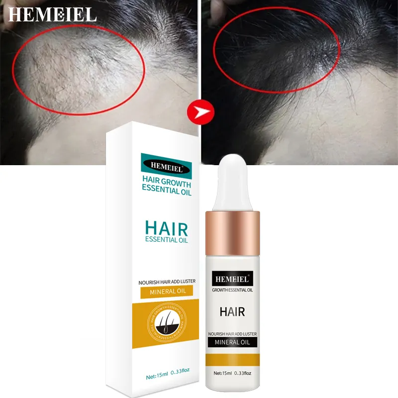 Wholesale Private Label Organic 15ml 0.5floz. Anti Hair Loss Hair Growth Oil Serum Drop For Women Men