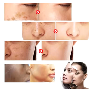 Sıcak satış Anti-Aging cilt beyazlatma takviyeleri <span class=keywords><strong>l</strong></span>-glutatyon kollajen C vitamini kapsü<span class=keywords><strong>l</strong></span> yetişkinler için (hamile kadınlar için değil) - Product Image 3