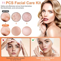 Kit d'outils pour éliminer les boutons, 11 pièces, extracteur de comédons, kit d'élimination rapide des points noirs et des boutons pour le front, le visage et le nez