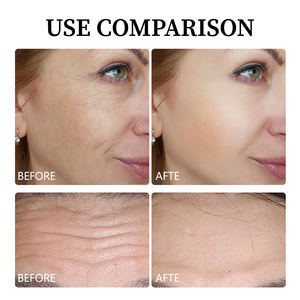 Crème pour le visage à l'extrait de céramide rétinol bakuchiol soins de la peau du visage marque privée coréenne beauté verre peau élimine les taches brunes lueur - Product Image 4