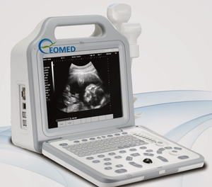 Grosir Rumah Sakit 12.1 inci penggunaan manusia dokter hewan Laptop B & W mesin pemindai <span class=keywords><strong>Ultrasound</strong></span> perangkat Echographie - Product Image 3
