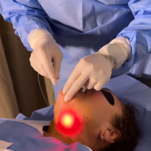 preço da máquina de laser endolift - Product Image 3