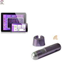 Microscope WiFi intelligent pour analyse du cuir chevelu et des cheveux, mini analyseur sans fil pour la peau et le cuir chevelu
