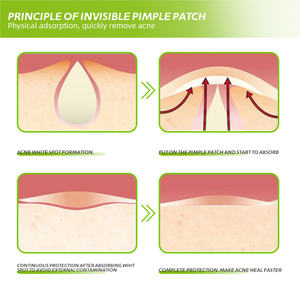 卸売デイナイト防水ケイ酸ティーツリーオイルスポットヒーリングビーガンクルーティフリーアンチアクネパッチ - Product Image 3