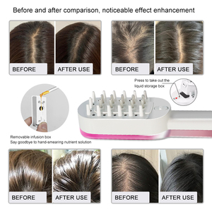 Gran oferta, peine masajeador de cuero cabelludo para estimular el crecimiento del cabello, peine para masaje del cuero cabelludo con vibración, masajeador de cabeza eléctrico - Product Image 5