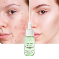 Puissant sérum d'huile d'arbre à thé d'acide salicylique 2% pour le traitement de l'acné réduction rapide des imperfections acné sévère visage liquide revitalisant