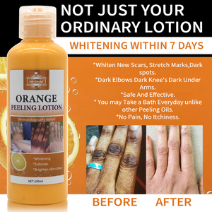 <span class=keywords><strong>Lotion</strong></span> Peeling Bio Extra Forte en Gros, <span class=keywords><strong>Exfoliante</strong></span> Visage et <span class=keywords><strong>Corps</strong></span>, Éclaircissante et Lissante pour Peau Foncée, <span class=keywords><strong>Lotion</strong></span> Peeling à l'Orange - Product Image 3