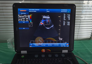 Système d'échographie pour clinique vétérinaire chinoise, dernier modèle, échographie portable couleur Doppler, scanner d'échographie - Product Image 2