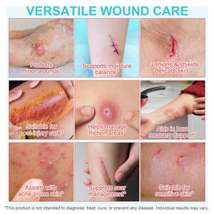 SEFUDUN şeffaf hidrokolloid yara pansuman rulo doğal şifa hidrokolloid yama desteği hidrokolloid rulo - Product Image 6