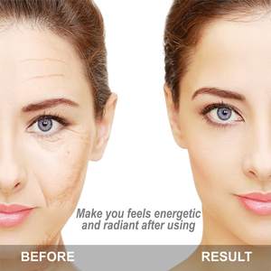 Rodillo Facial de Piedra de <span class=keywords><strong>Jade</strong></span> Natural Negra con Doble Piedra para Alivio de la Tensión, Estiramiento Facial y Reafirmación de la Piel - Product Image 3