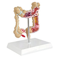Modelo de Simulación Médica DARHMMY del Colon y Intestino Grueso Humano