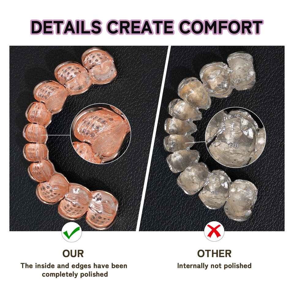 DOPE Jewelry Moissanite Grillz Bottom Custom Hip Hop Grillz Teeth ...