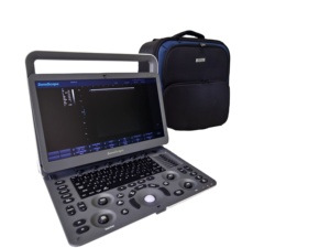 Échographe Doppler couleur vétérinaire Sonoscape E3V/E3/E3 Pro avec sonde cardiaque PW CW pour animaux de grande et petite taille - Product Image 6