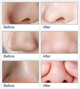 Logotipo personalizado NAD + Booster <span class=keywords><strong>Skin</strong></span> Care Soro Hidratação Profunda Removedor de Mancha Escura Anti-Envelhecimento Rugas Resveratrol Vitamina C <span class=keywords><strong>E</strong></span> para o Rosto - Product Image 5