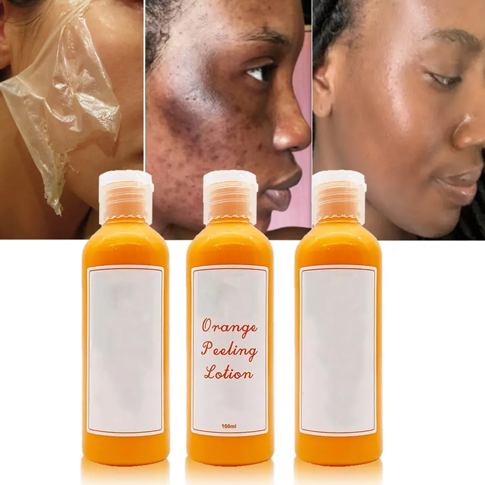 Oranje Verwijder Dode Huid Whitening Knokkels Body Facial Exfoliator Huidverzorgingsserum Exfoliërende Body Face Oranje Peeling Olie