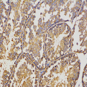 Antibodi Anti -GAPDH Mouse Antibodi Monoklonal - Product Image 4