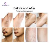 Appareil d'épilation au laser diode 808 sans douleur, approuvé CE, OEM, Salon Spa, haute fréquence, ICE Titanium, 4 longueurs d'onde, professionnel