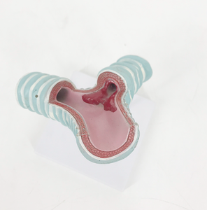 Moodel của sự phân chia khí quản - Product Image 1