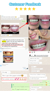 Systèmes professionnels de blanchiment des dents en gros, gel de blanchiment des dents avancé, logo privé pour kit de clinique, utilisation en salon - Product Image 5