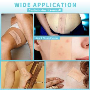 Rollo de vendajes de hidrocoloide actualizado de grado médico OEM para el cuidado de heridas con autoadhesivo Flexible impermeable forma de tamaño DIY - Product Image 5