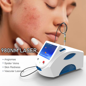 Láser de Diodo de 980nm para Eliminación Vascular, Tratamiento de <span class=keywords><strong>Arañas</strong></span> <span class=keywords><strong>Vasculares</strong></span>, Enrojecimiento Facial y Capilares - Product Image 2