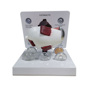 Modelos de Ojos de CIENCIA MÉDICA PARA glaucoma y cataratas - Product Image 2